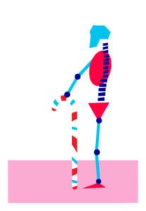Cartoon of a festive skeleton with swollen joints holding a candy cane as a walking cane