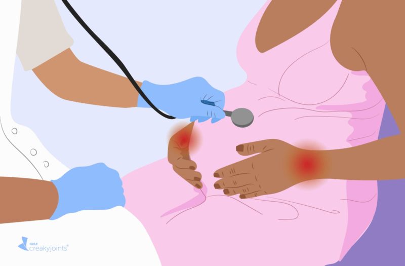 Illustration of a doctor holding a stethoscope to a pregnant woman's belly. The woman has rheumatoid arthritis, as evident by red pain spots on her wrist.
