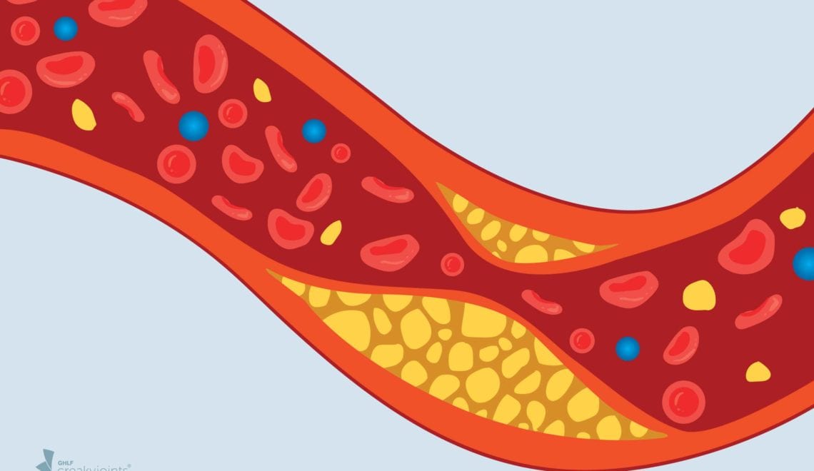 Cholesterol Levels