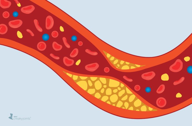 Cholesterol Levels