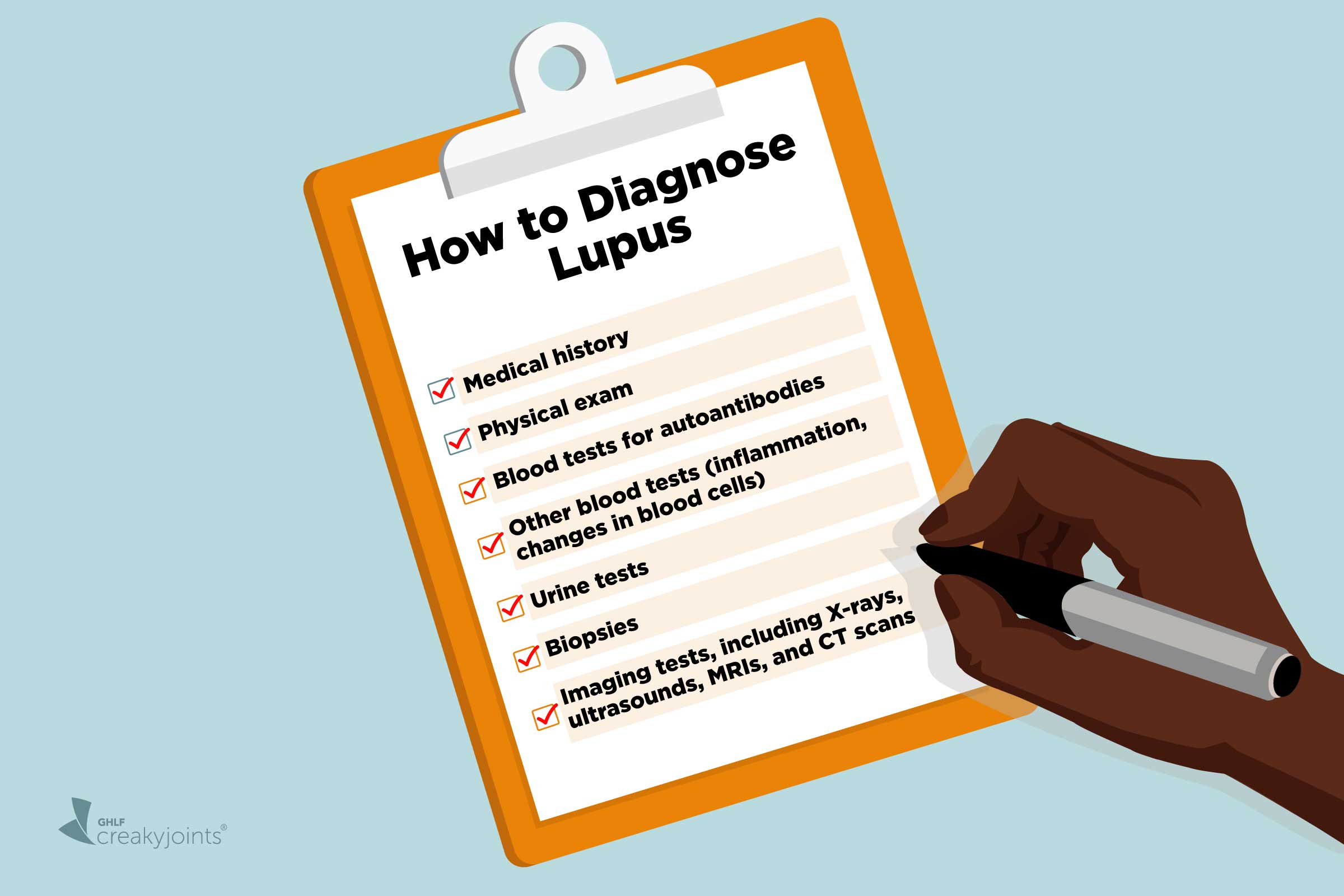 how to test for lupus        
        <figure class=