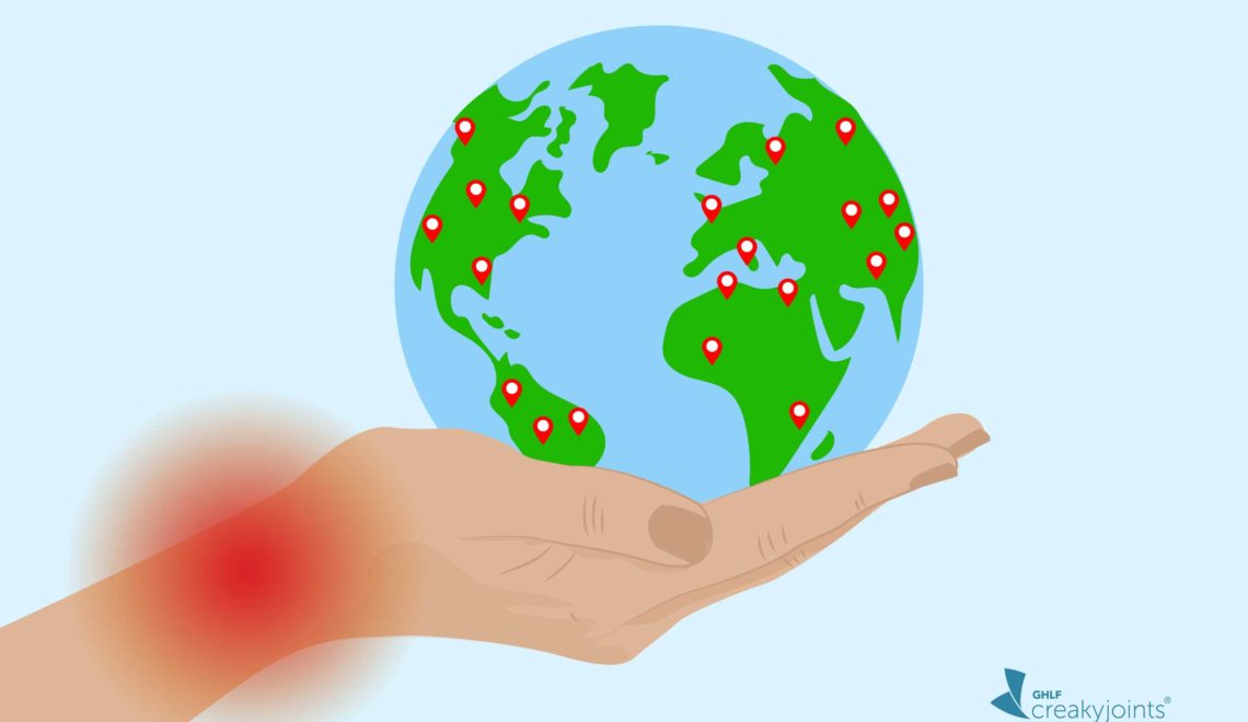 Coronavirus with Rheumatoid Arthritis