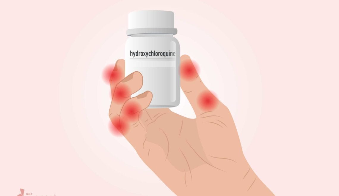 Hydroxychloroquine hand arthritis