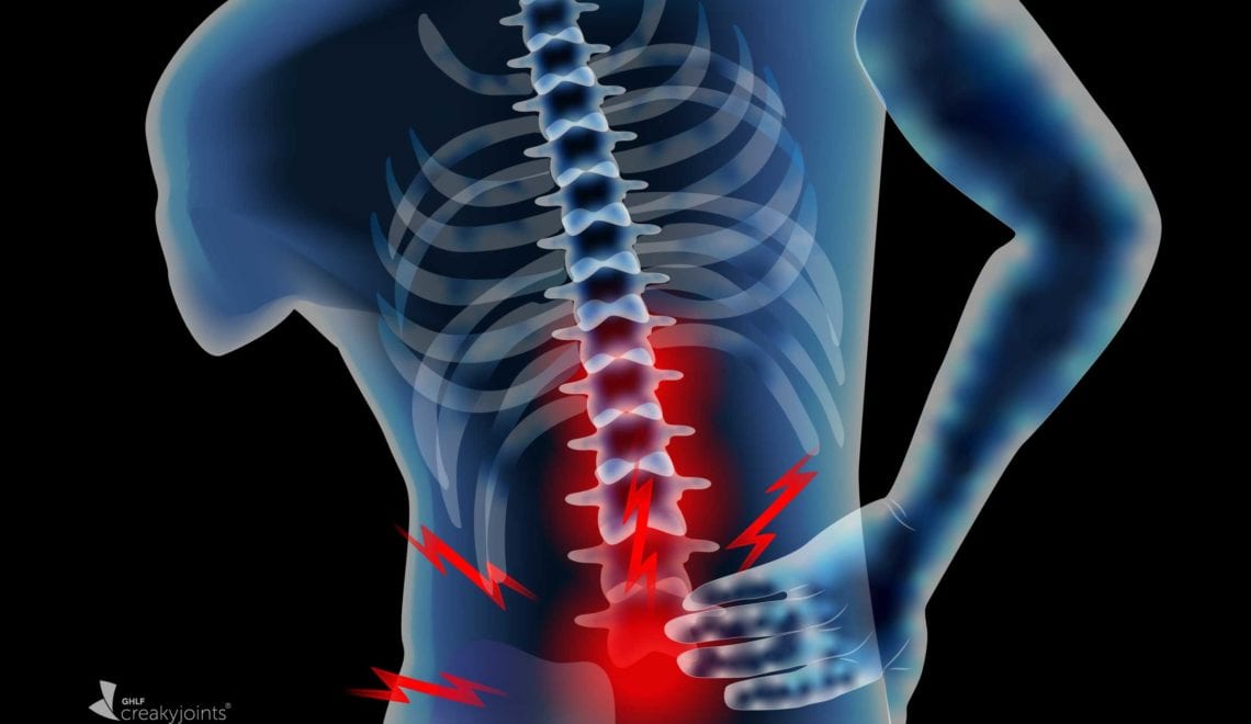 Lower Back Pain Image