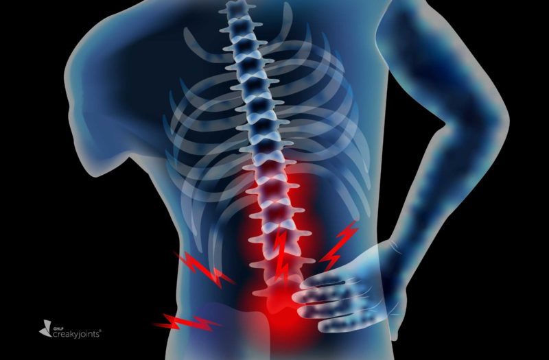 Few Non Radiographic Axial Spondyloarthritis Patients End Up With Spine