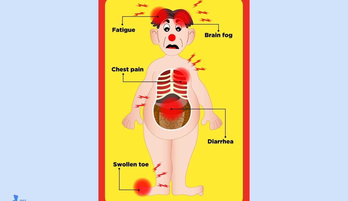 COVID/ RA Operation Graphic