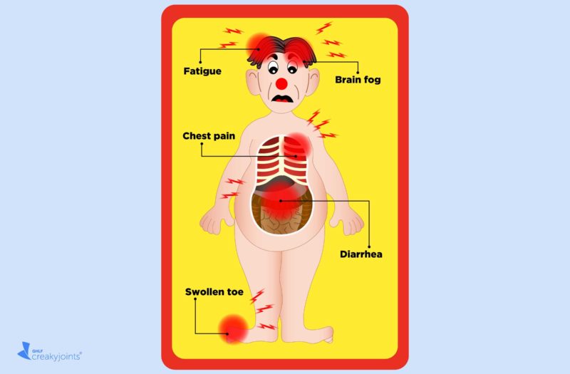 COVID/ RA Operation Graphic