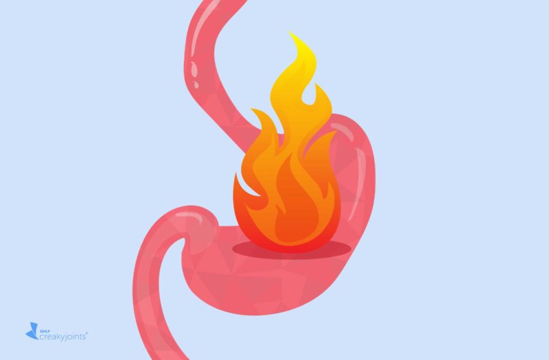 Heartburn Acid Reflux