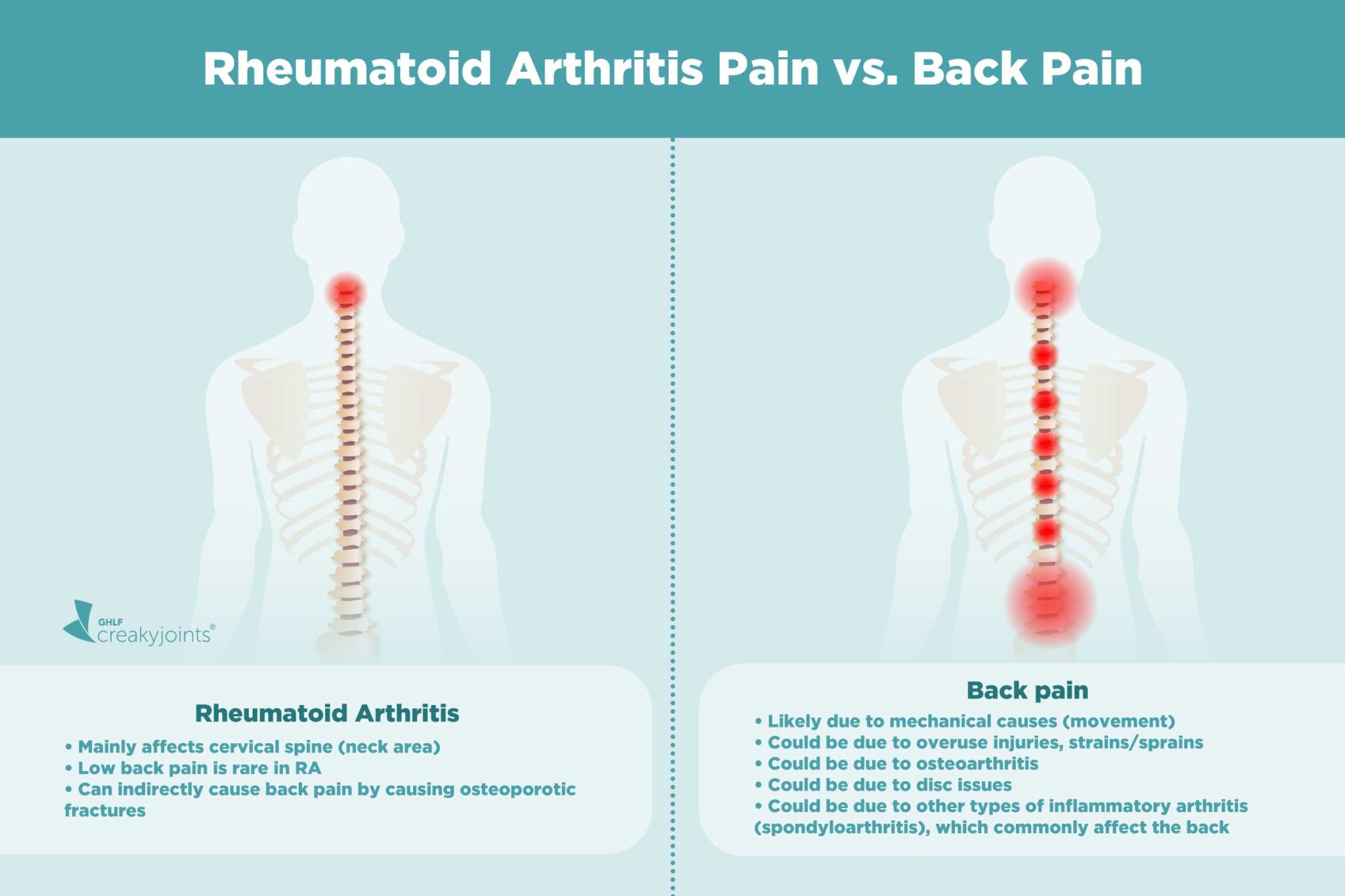 causes-of-rheumatoid-arthritis-pain-aside-from-inflammation