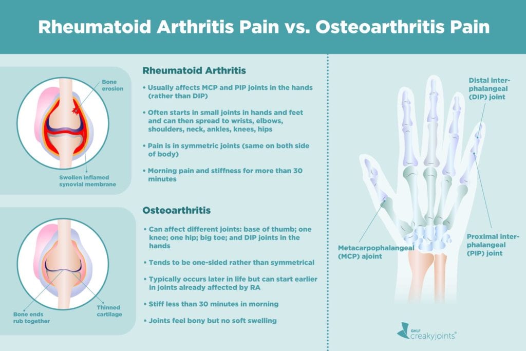 Causes Of Rheumatoid Arthritis Pain Aside From Inflammation   0720 Osteoarthritis Vs RA 1024x683 