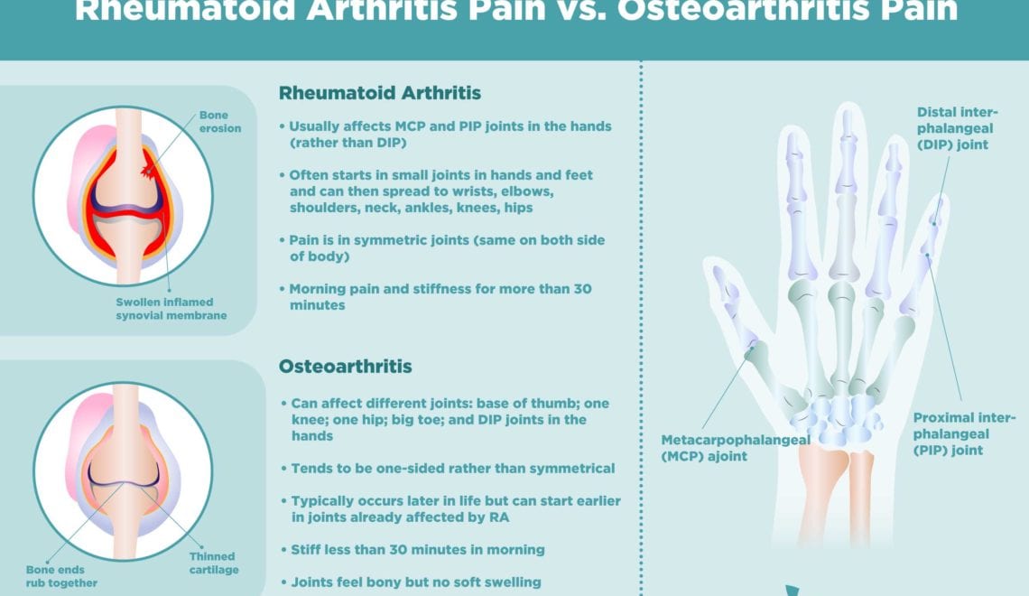 Osteoarthritis Pain vs. Rheumatoid Arthritis Pain