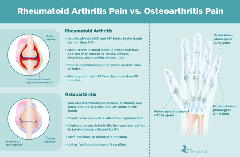 Osteoarthritis Pain vs. Rheumatoid Arthritis Pain