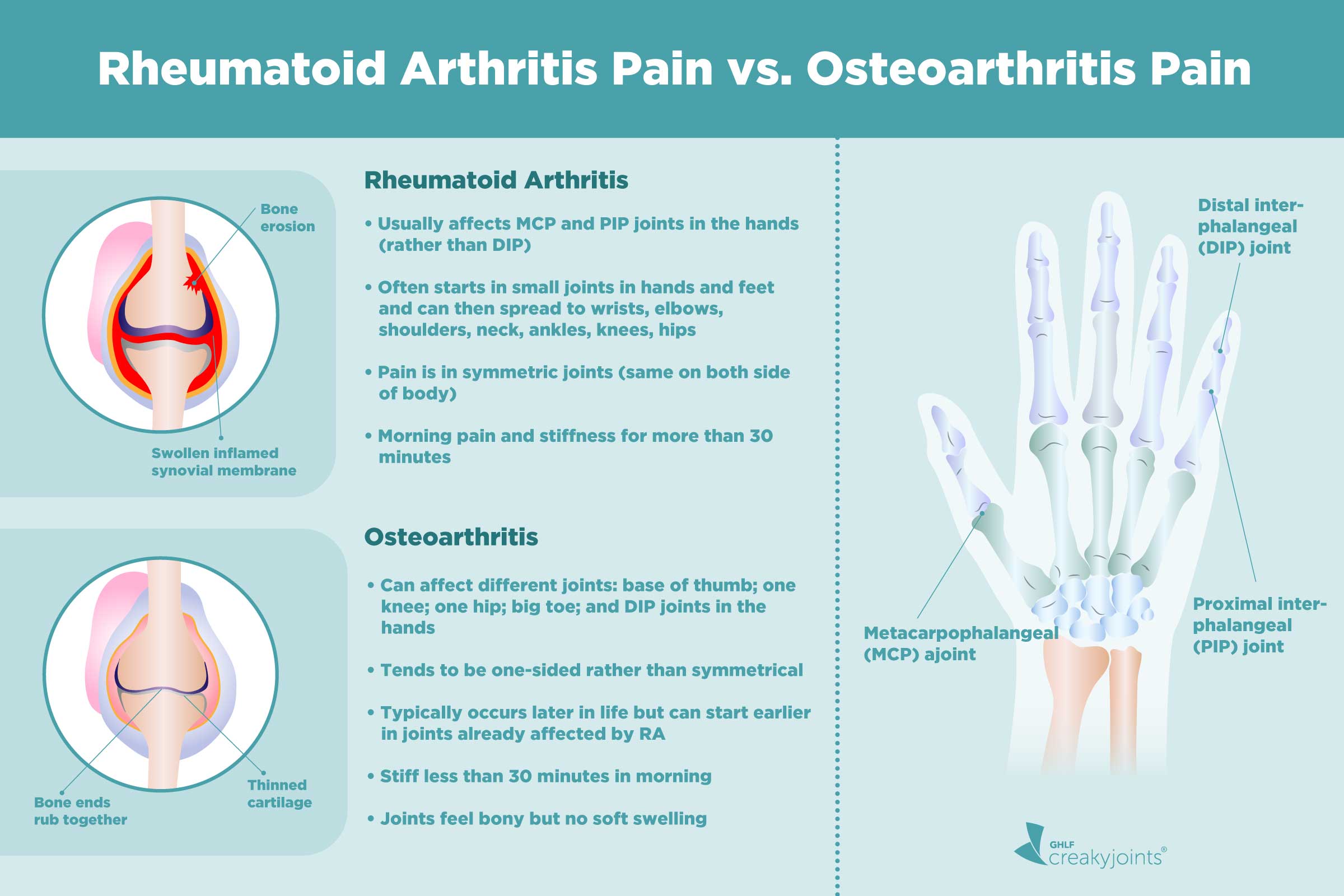 0720 Osteoarthritis Vs RA 