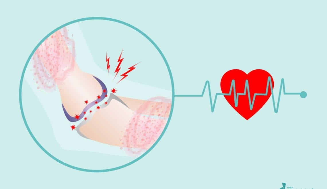 Heart Cardiovascular Disease Psoriatic Arthritis