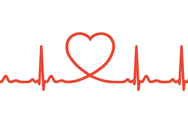 EKG heart rhythm