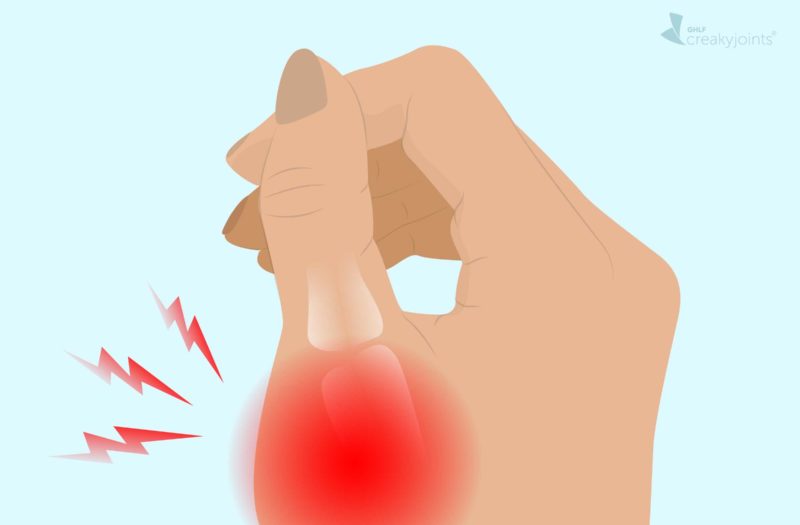 Gout Pain in Thumb