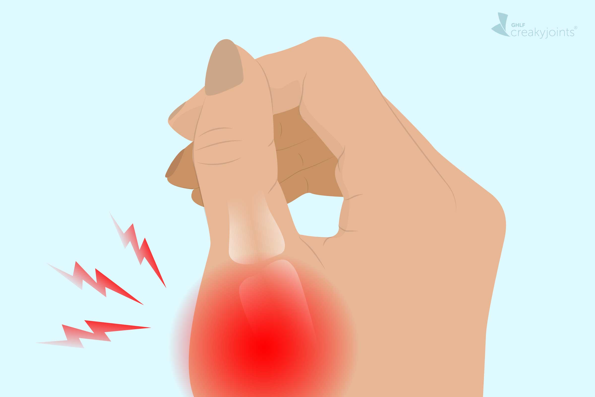 gout-in-the-thumb-symptoms-causes-treatments