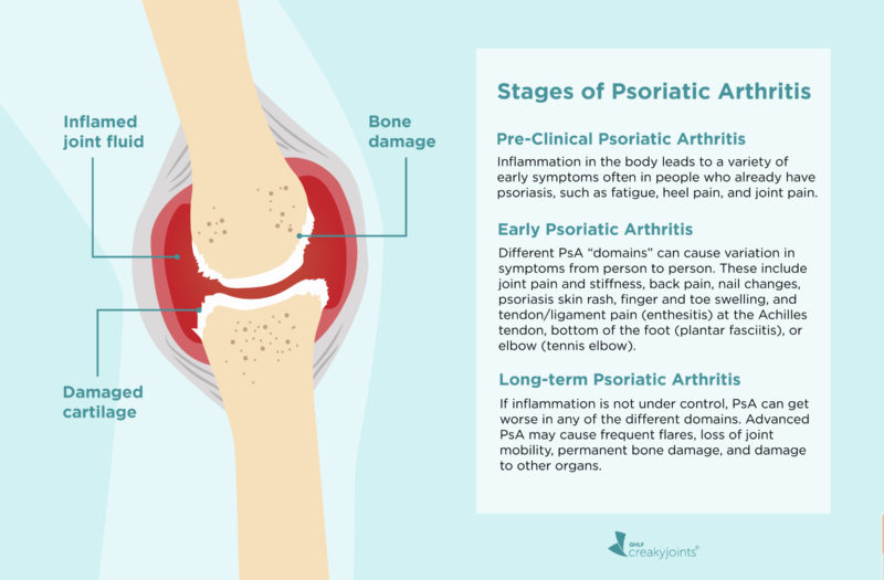 can psoriasis get worse with age