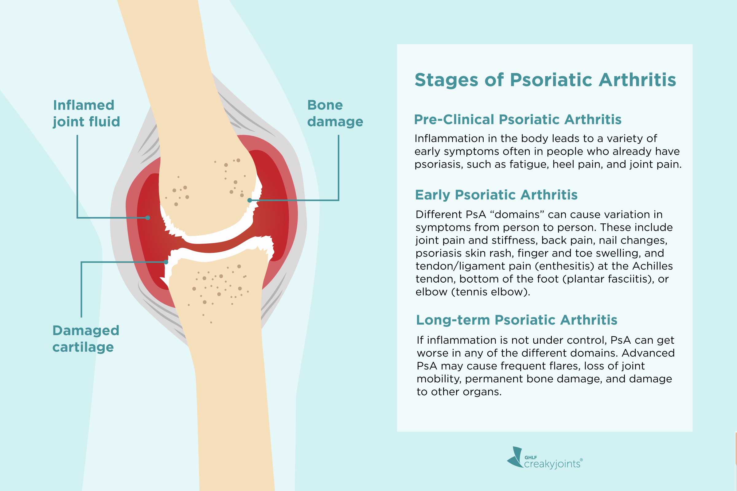 plaque psoriasis cause joint pain