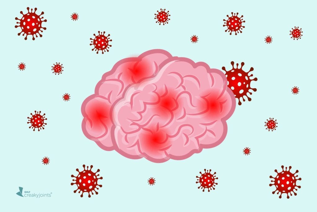 covid brain fog duration