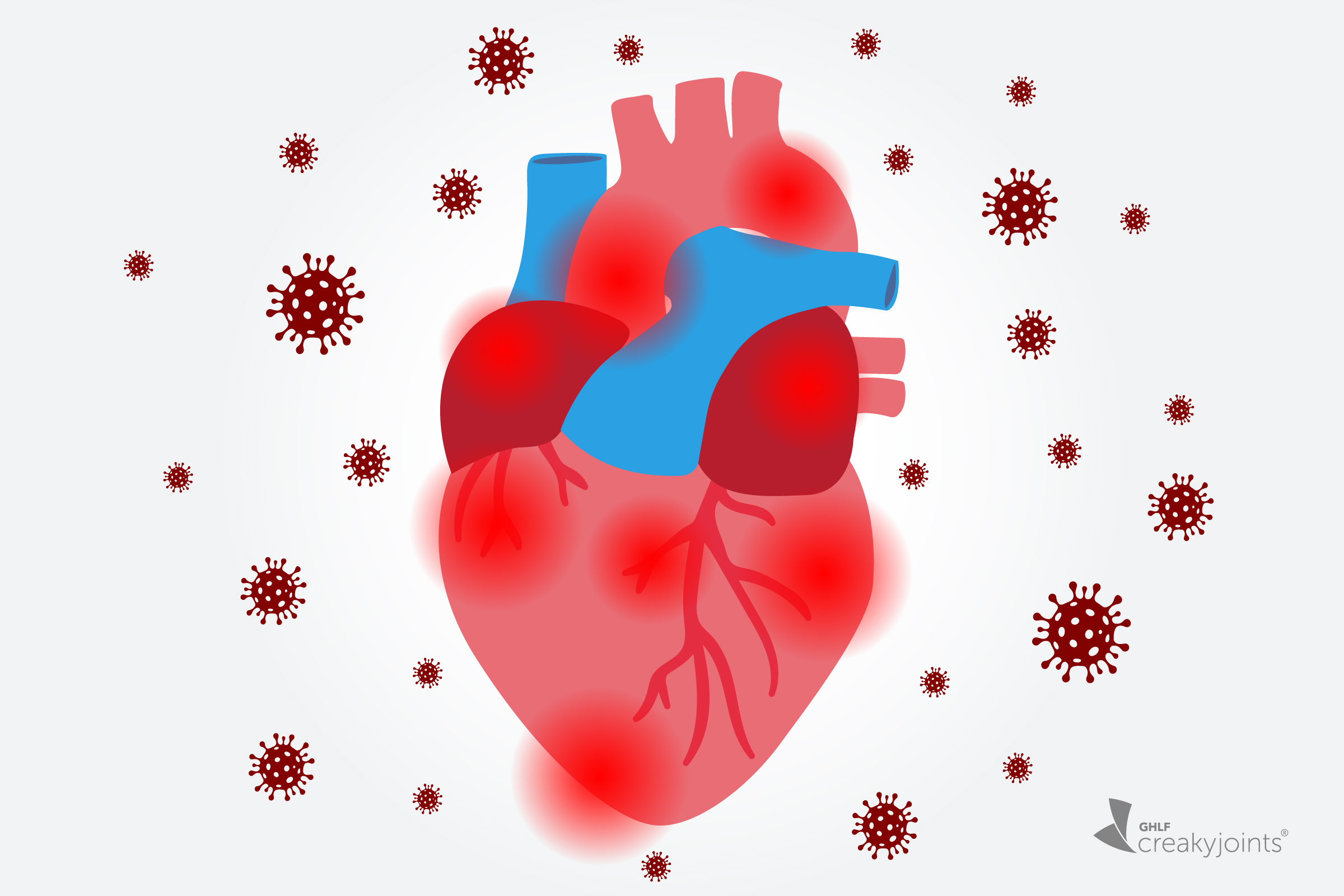 How COVID-19 Affects the Heart: What Rheumatic and Inflammatory Disease  Patients Should Know