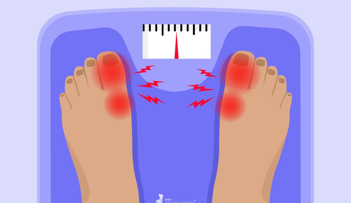 An illustration of feet suffering a gout flare up standing on a scale.