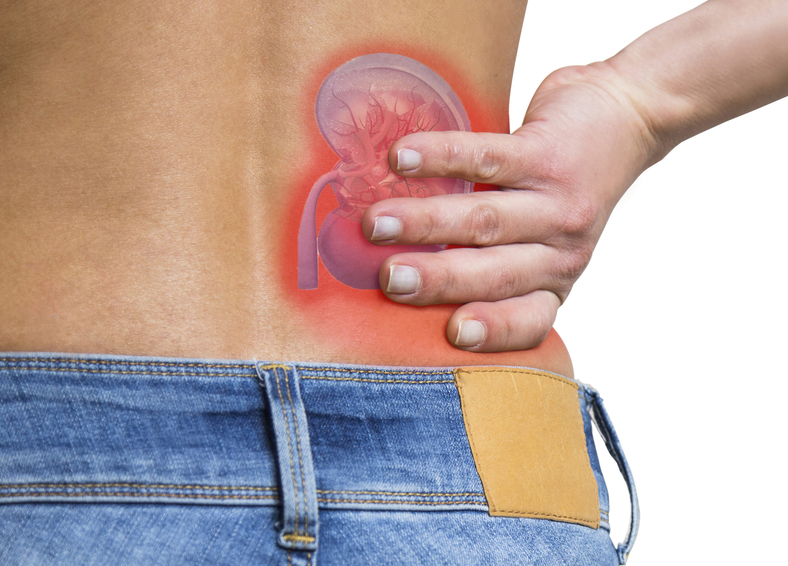Kidneys and Back Pain