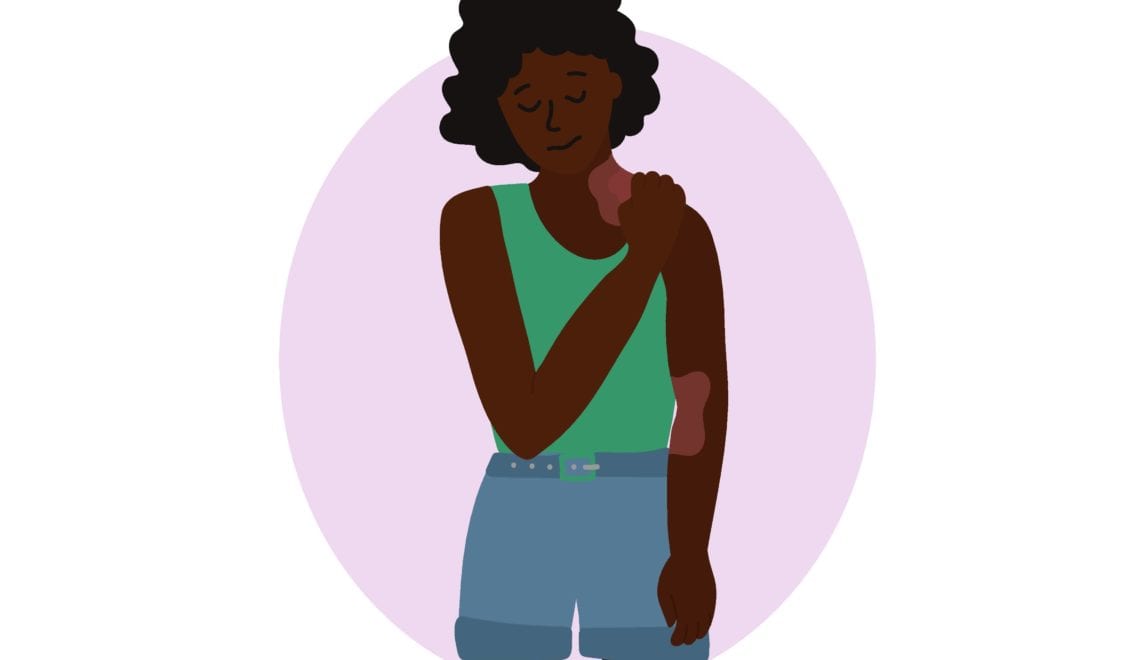 An illustration of a woman of color itching skin plaques caused by psoriasis.