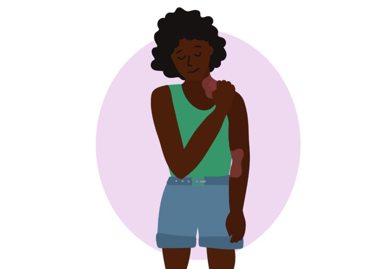 An illustration of a woman of color itching skin plaques caused by psoriasis.