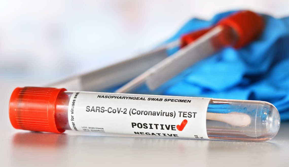 A vial with cotton swab inside. On the label, it reads "SARS-CoV-2 (Coronavirus) TEST." There is a red checkmark next to word positive. Blurred vials and blue nitrile gloves are in the background.