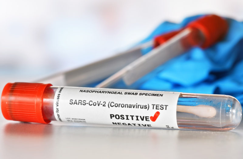 A vial with cotton swab inside. On the label, it reads "SARS-CoV-2 (Coronavirus) TEST." There is a red checkmark next to word positive. Blurred vials and blue nitrile gloves are in the background.
