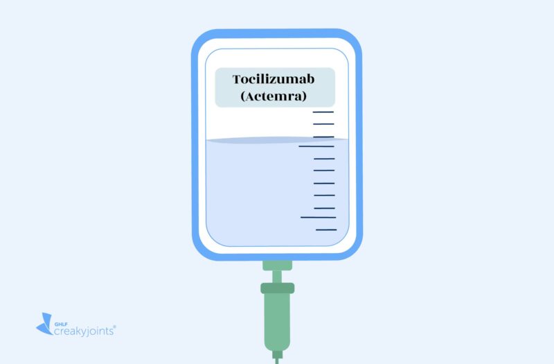 An illustration of an IV bag filled with a clear liquid. There is a label on the IV bag that says Tocilizumab (Actemra) .