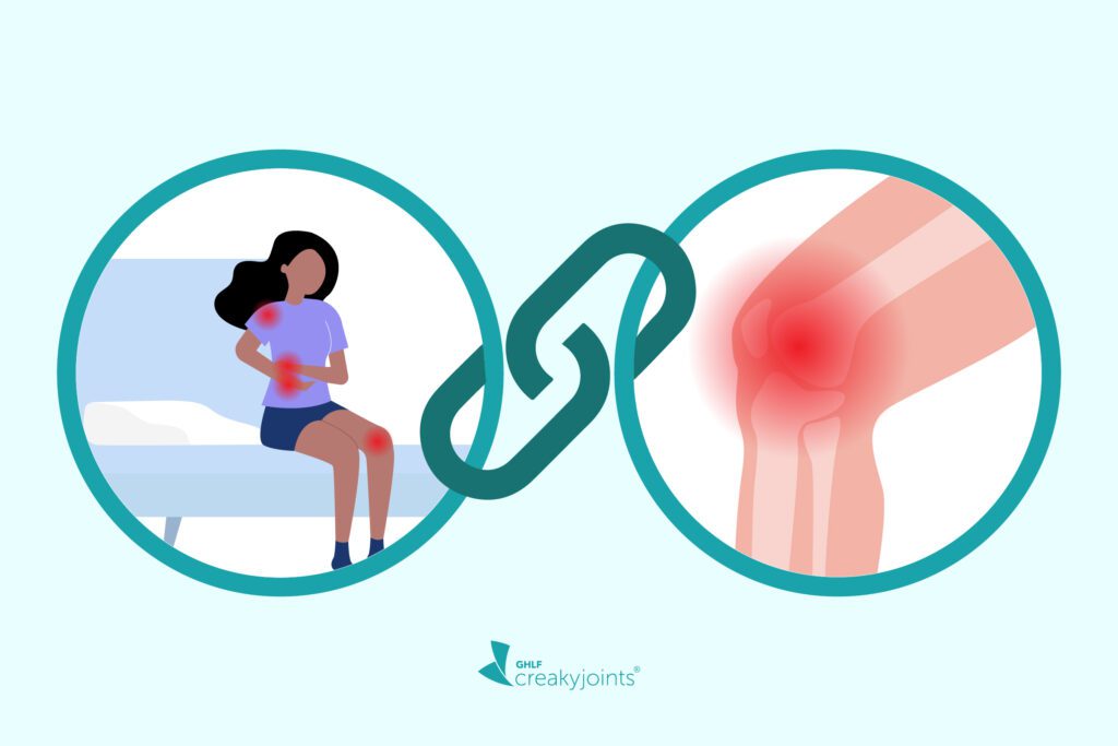 Illustration showing link between sleep with woman on left and OA with picture of knee with red flare spots on left