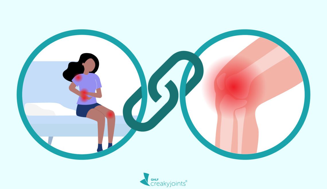 Illustration showing link between sleep with woman on left and OA with picture of knee with red flare spots on left