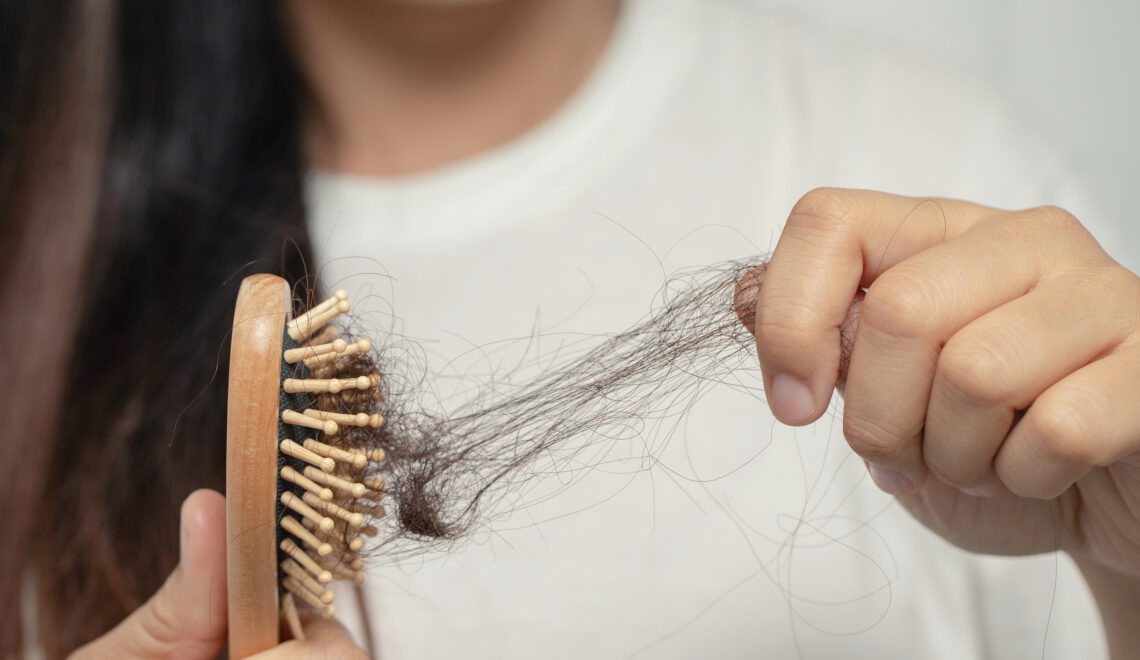 Photograph of woman losing hair in hair brush