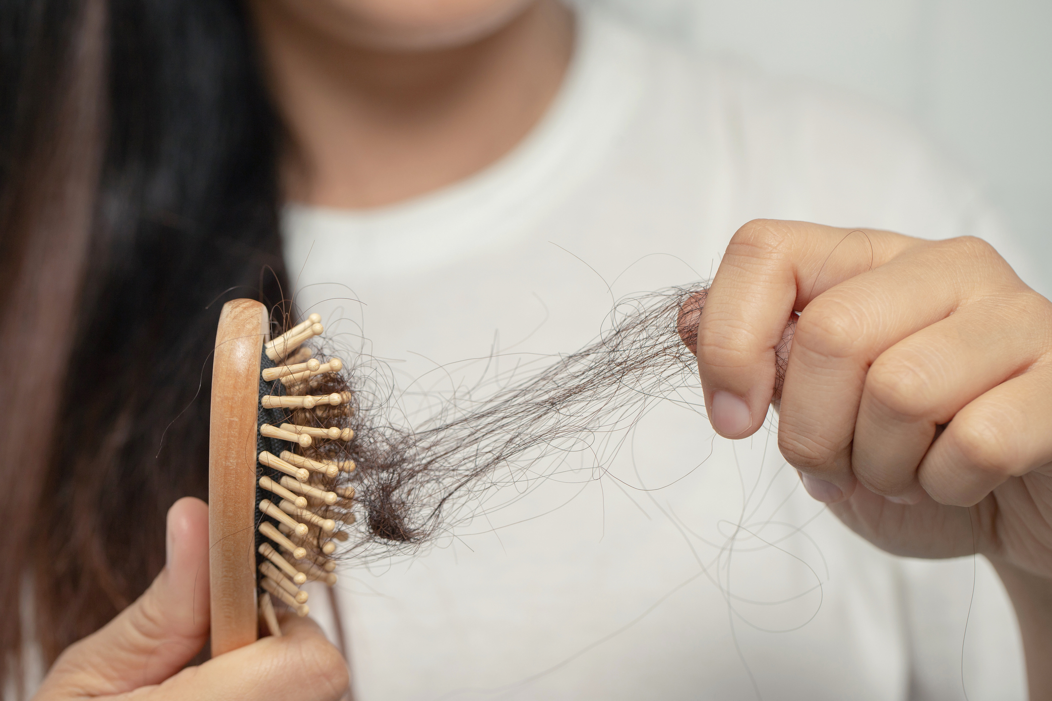 Photograph of woman losing hair in hair brush