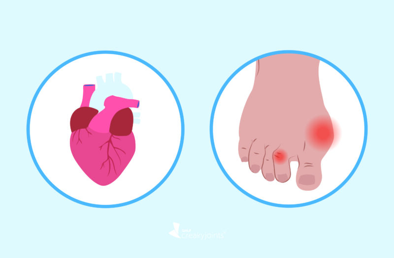 illustration of heart and foot with gout flare