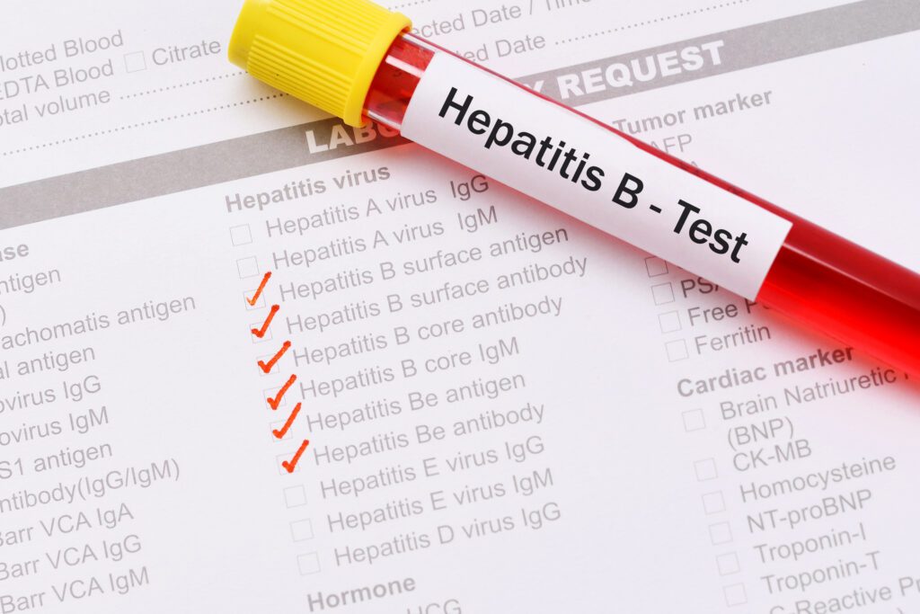 Photograph of a blood sample with form for testing for hepatitis B