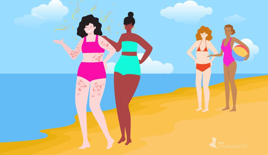 Illustration of person with psoriasis being gawked at on beach