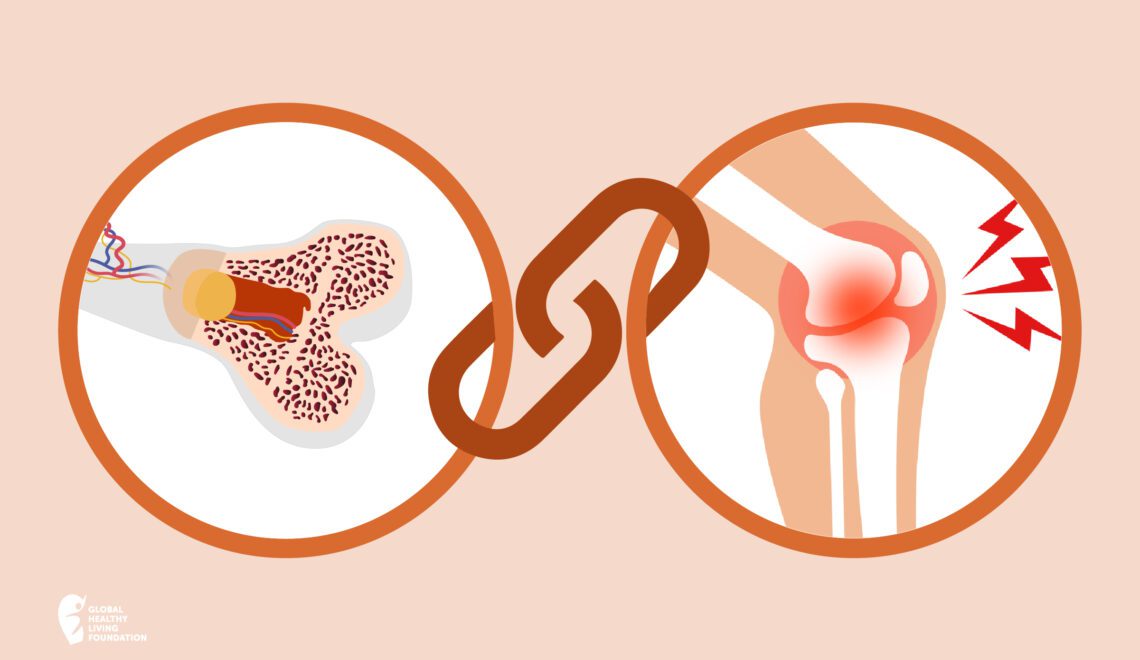 illustration of circles with link to represent link between osteoporosis and arthritis