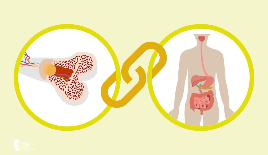 Cartoon illustration of Osteoporosis and IBD