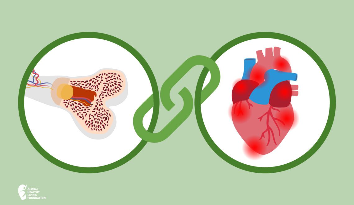 Illustration showing link between osteoarthritis and heart health