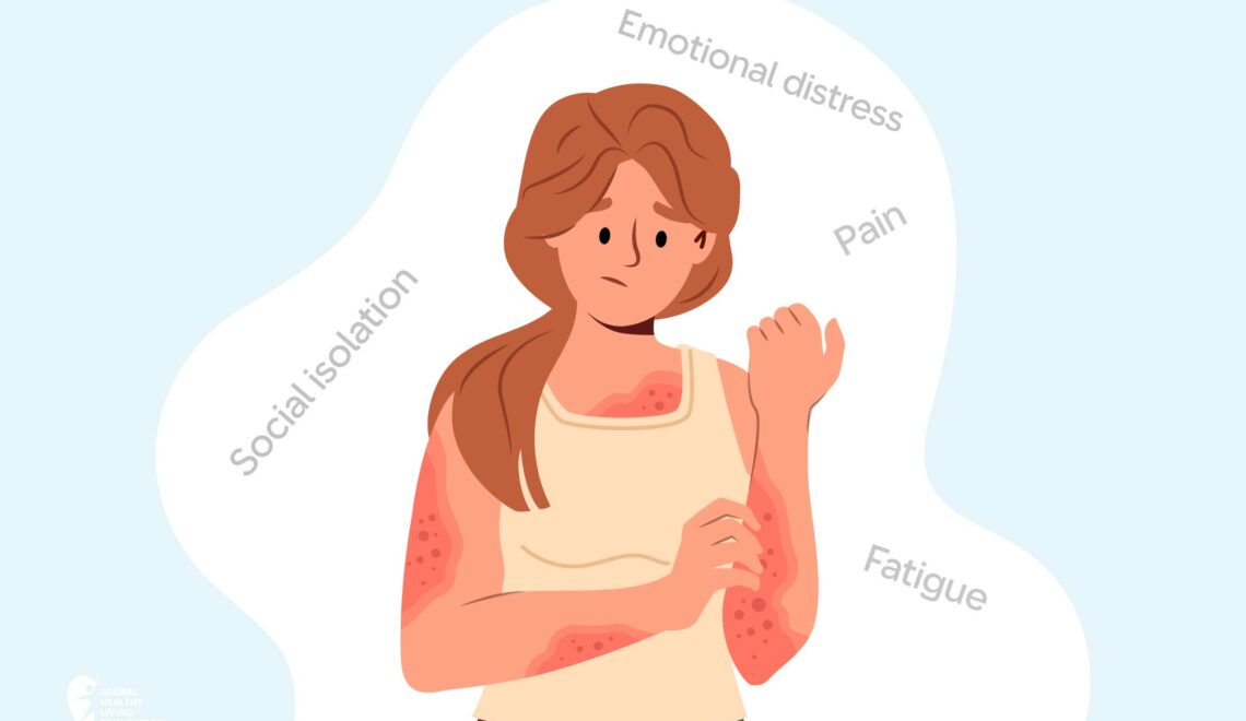 Understanding-the-Visible-and-Invisible-Symptoms-of-Psoriatic-Disease-