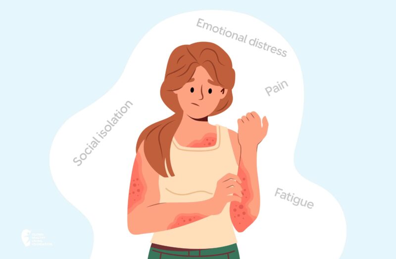 Understanding-the-Visible-and-Invisible-Symptoms-of-Psoriatic-Disease-